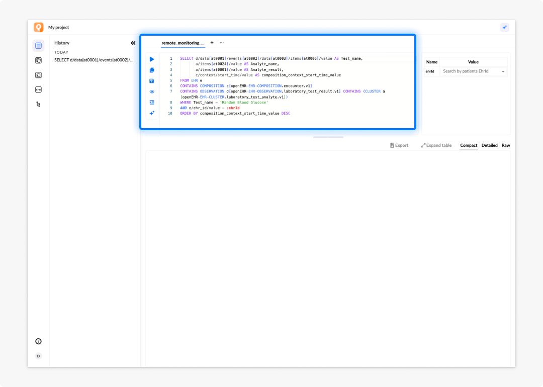 Query editor